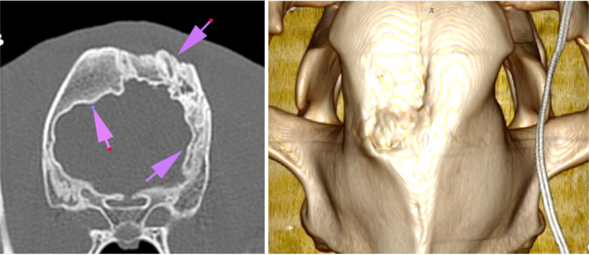 scans of a skull